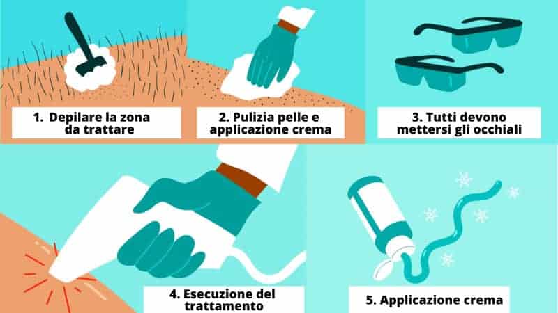epilazione-laser-passaggi-trattamento