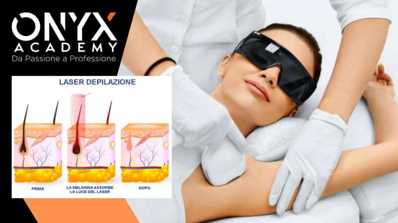 come-funziona-epilazione-laser